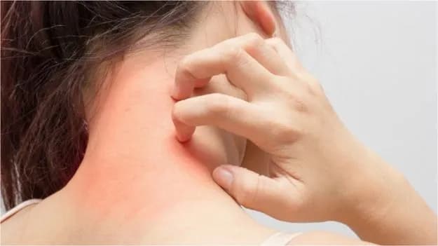 Frequent Skin Itching: A Warning Sign Your Kidneys May Need Attention