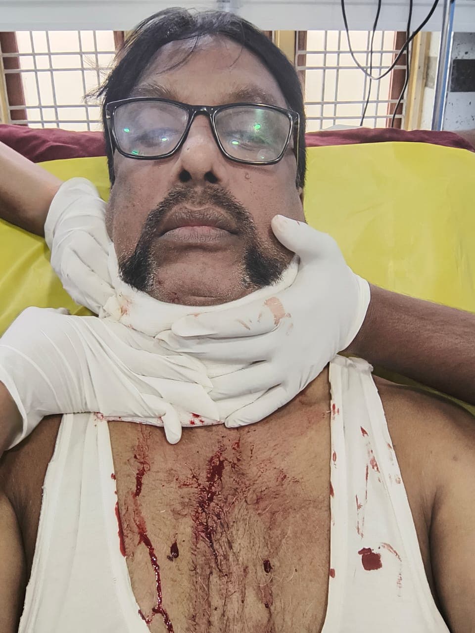 ASI Nagaraju injured in China Maanja incident; condition stable